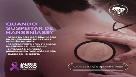 Olímpia promove campanha “Janeiro Roxo” de conscientização sobre a hanseníase